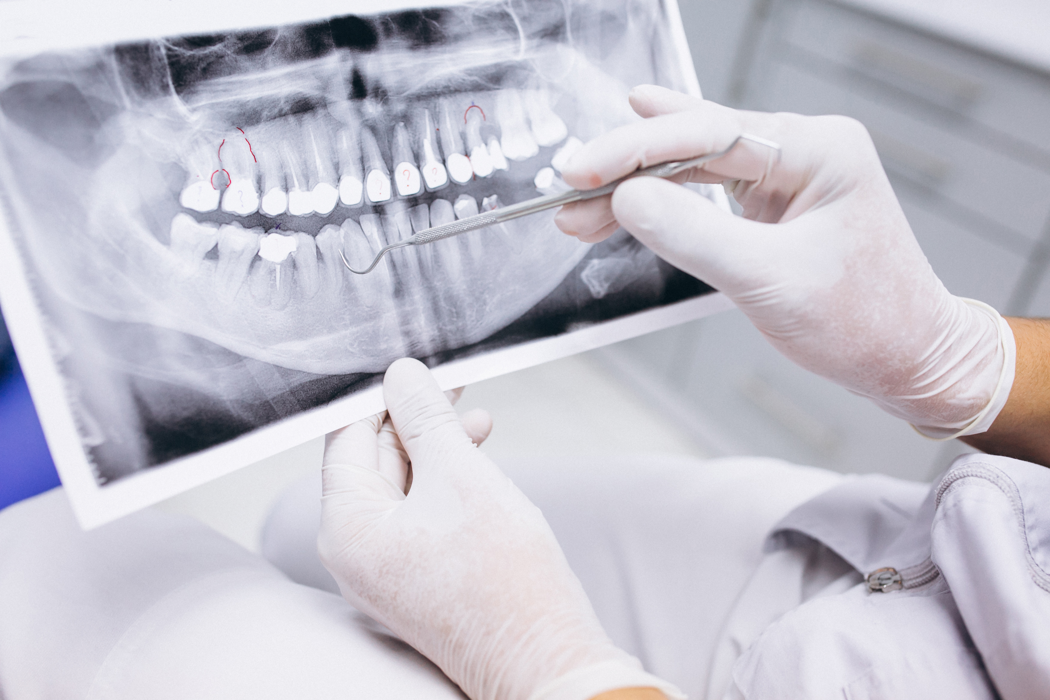 Diagnostico y tratamiento